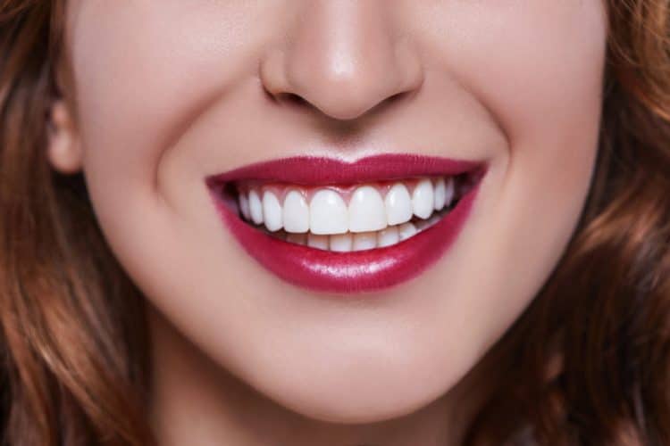 veneer smile orthodonticts perfect smiles family dentistry